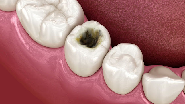 Dentalna usluga